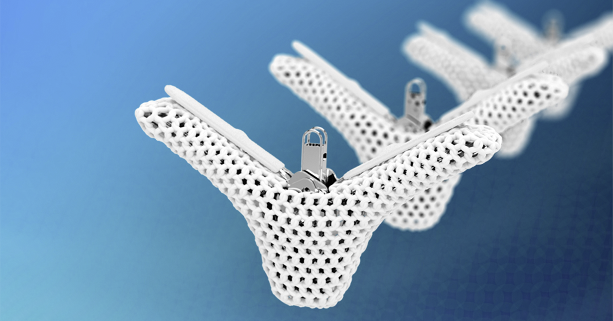 Tricuspid Valve Repair Proven to Reduce Heart Failure Events