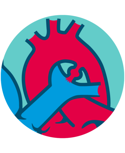 Complex type patent ductus arteriosus