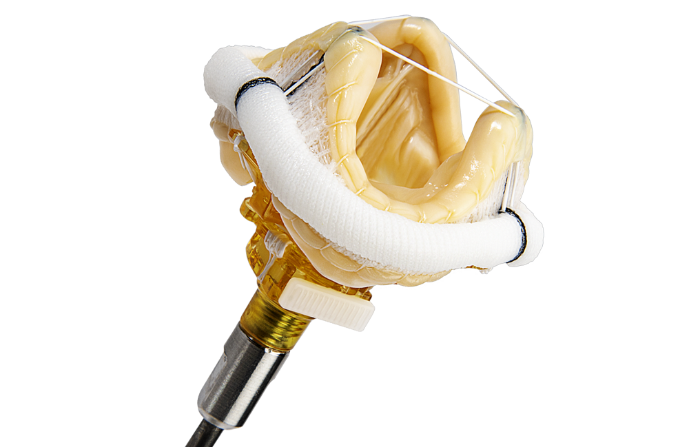 Surgical valve solutions