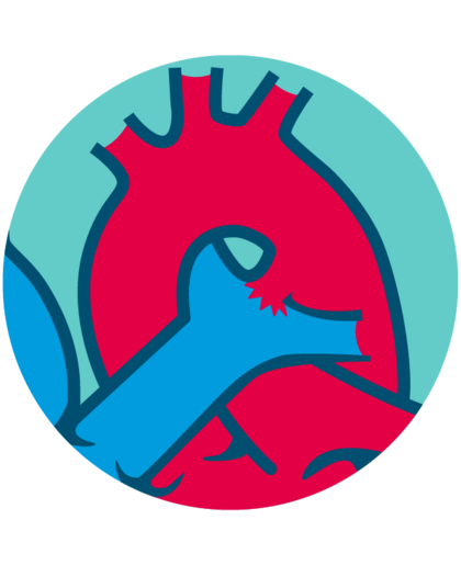 Window type patent ductus arteriosus