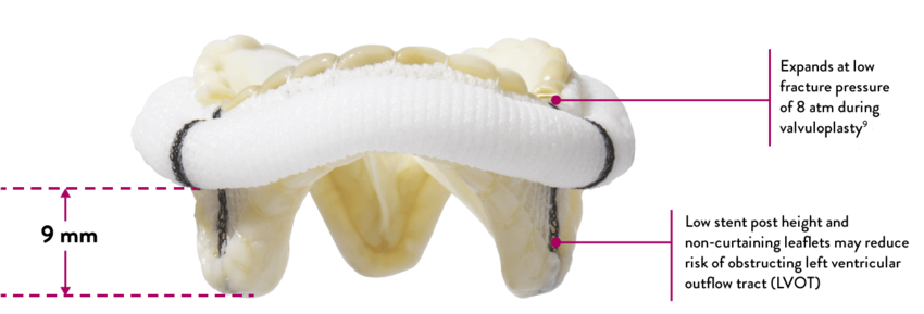 Epic Plus mitral valve stent posts help preserve LVOT