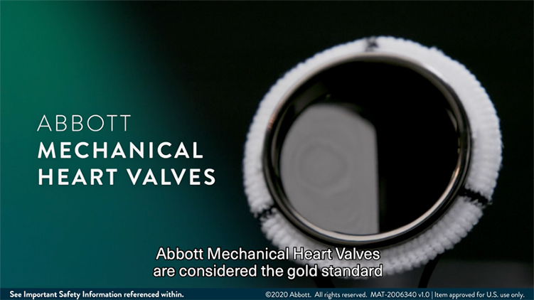 On-X versus St Jude Medical Regent mechanical aortic valve prostheses:  early haemodynamics