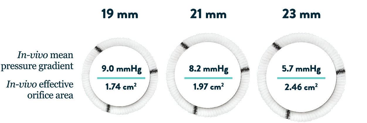 Abbott Regent aortic valve features exceptional hemodynamics