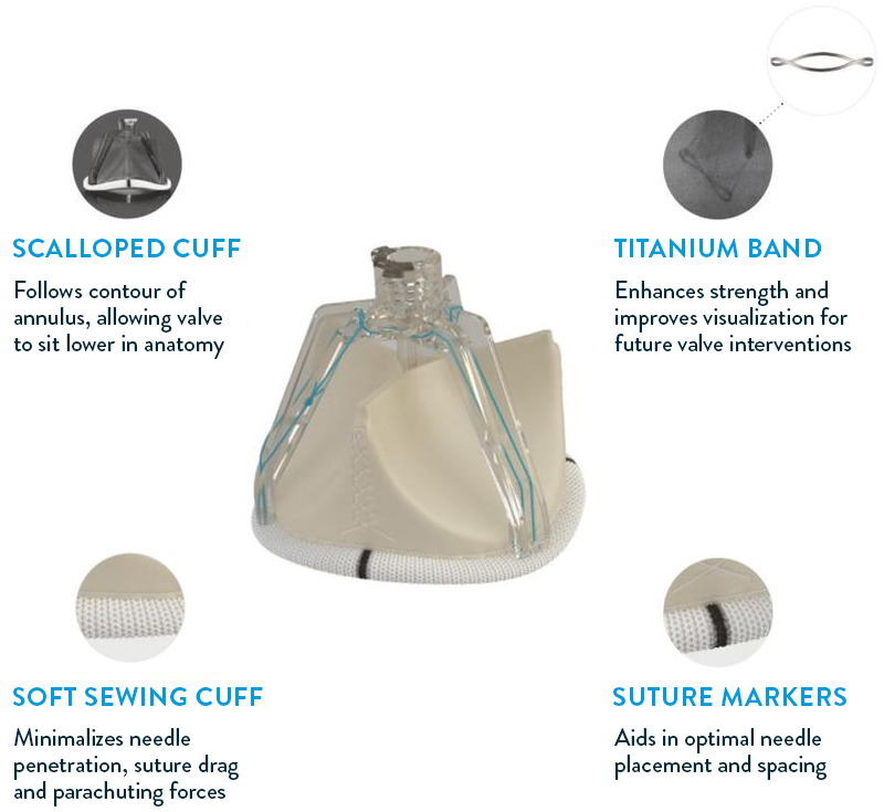 Abbott Trifecta GT surgical valve features Abbott Trifecta GT surgical valve features