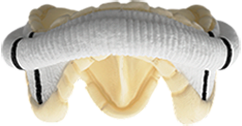 Epic Plus Supra stented tissue valve