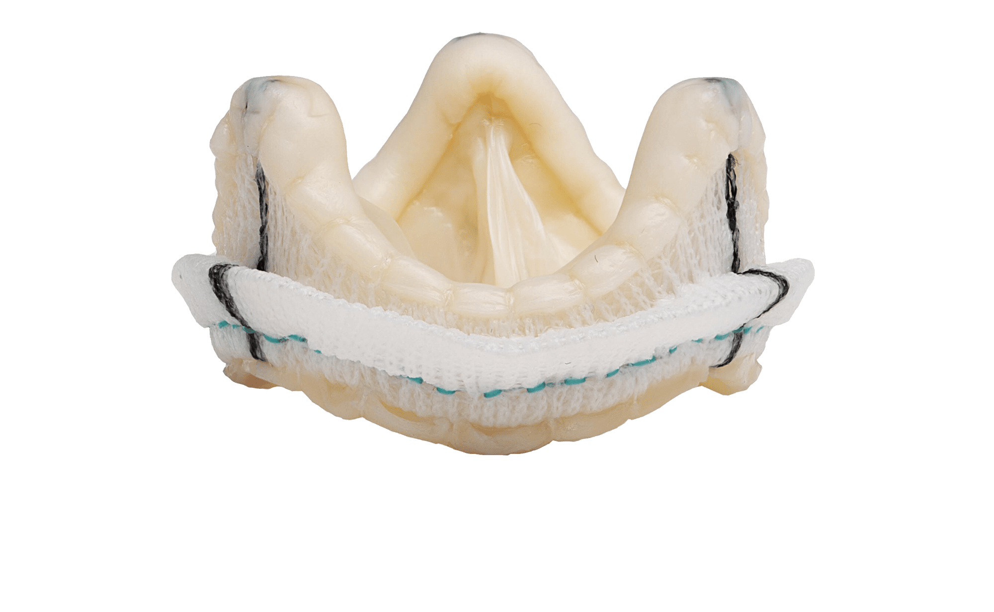 Epic Supra stented tissue valve