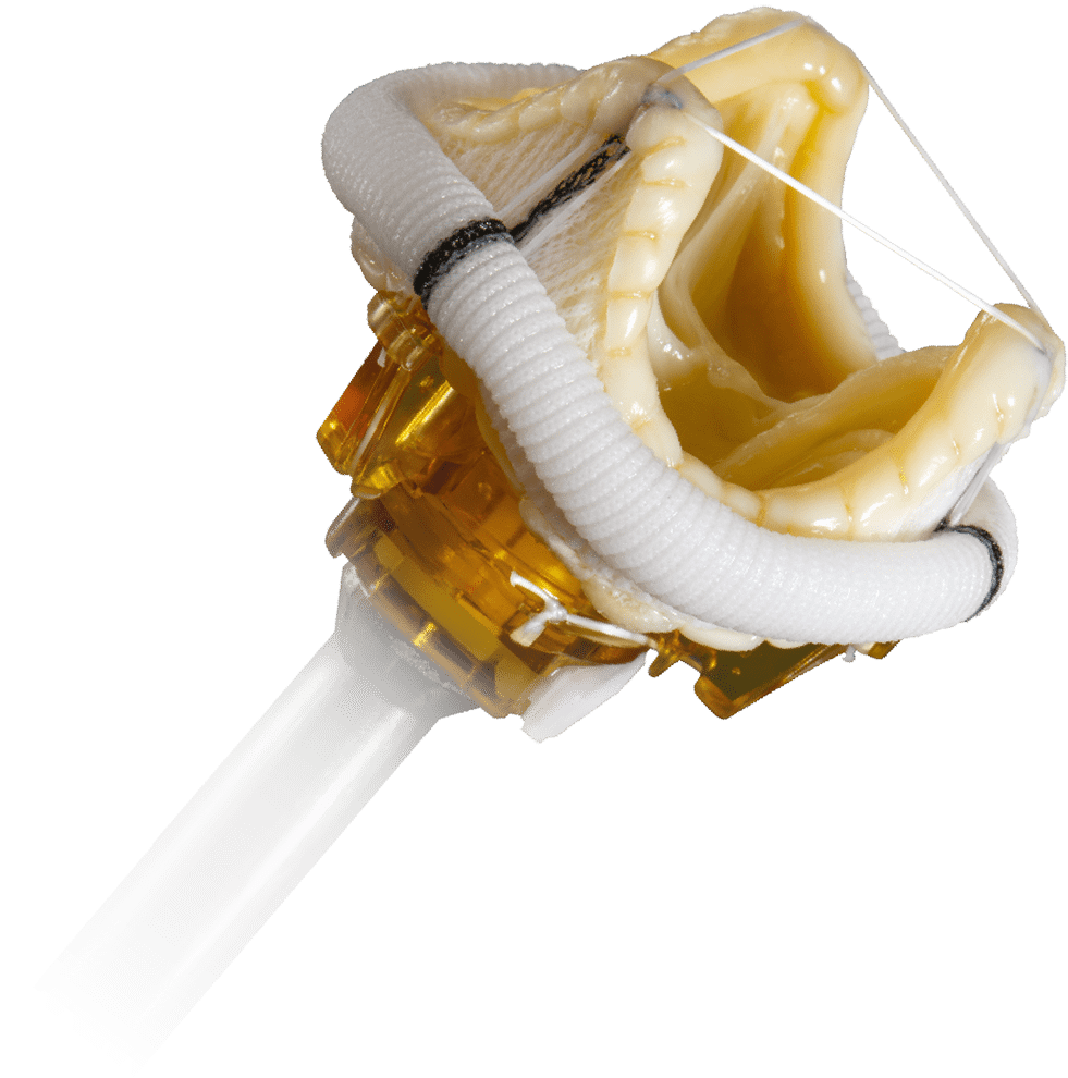 Epic Plus Supra mitral stented tissue valve features