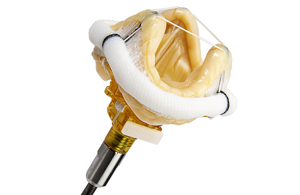 Surgical valve solutions Surgical valve solutions