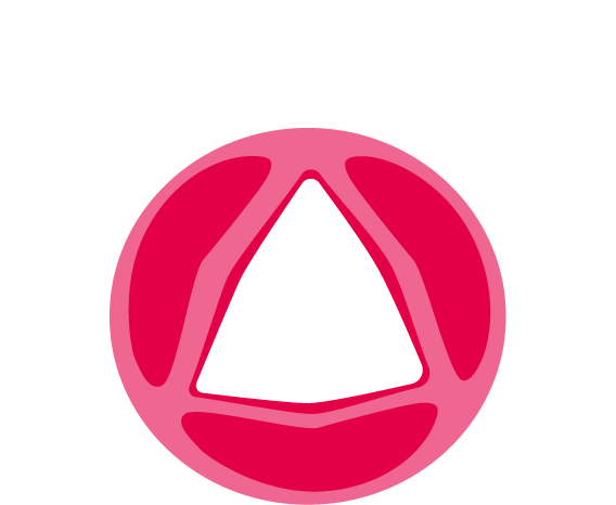 Normal aortic valve without stenosis