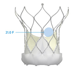 29 mm Navitor valve design