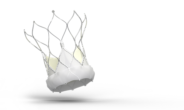 Navitor aortic valve