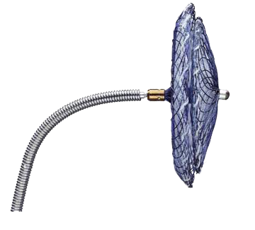 Amplatzer PFO Occluder comes assembled to Trevisio delivery cable, ready to use Amplatzer PFO Occluder comes assembled to Trevisio delivery cable, ready to use