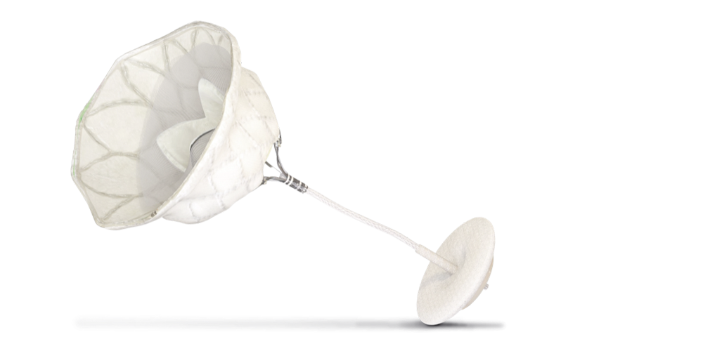 Tendyne Transcatheter Mitral Valve Replacement (TMVr) Tendyne Transcatheter Mitral Valve Replacement (TMVr)