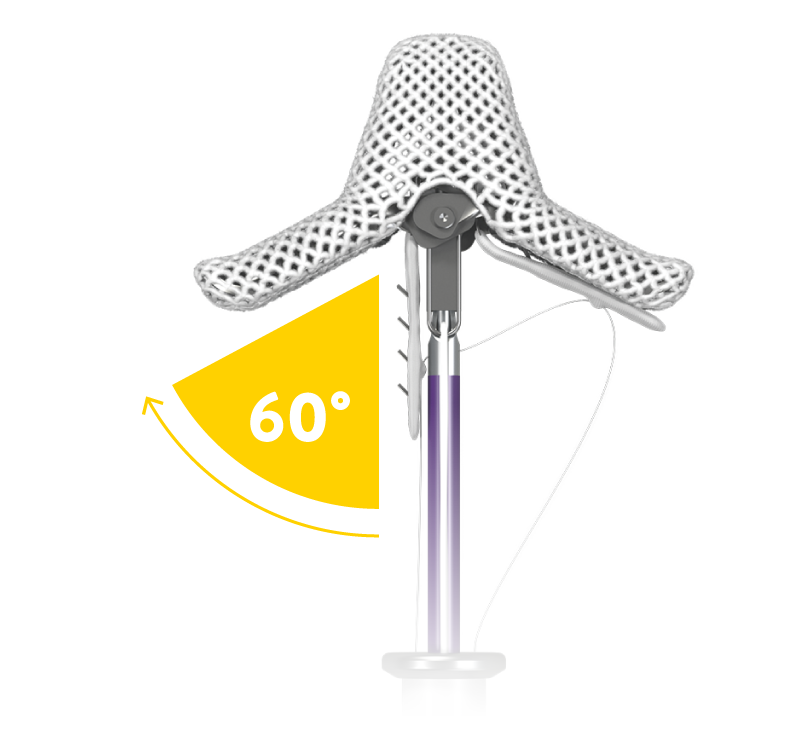 Optimized leaflet capture for consistent TR reduction with the TriClip G4 TEER System