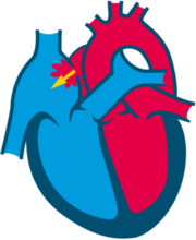 Atrial Septal Defect